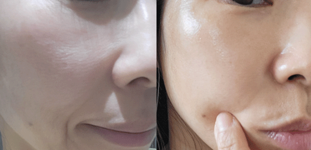 پک ۶ ساشه ای سرم میکرونیدلینگ ریدل شات کوچک کننده منافذ، تقویت بافت پوست،، صاف کننده و درخشان کننده پوست و رفع لک و جای جوش از برند Vt cosmetics
