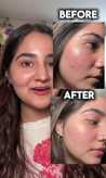پک ۶ ساشه ای سرم میکرونیدلینگ ریدل شات کوچک کننده منافذ، تقویت بافت پوست،، صاف کننده و درخشان کننده پوست و رفع لک و جای جوش از برند Vt cosmetics
