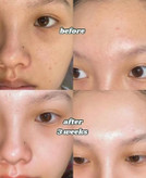 پک ۶ ساشه ای سرم میکرونیدلینگ ریدل شات کوچک کننده منافذ، تقویت بافت پوست،، صاف کننده و درخشان کننده پوست و رفع لک و جای جوش از برند Vt cosmetics