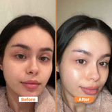 فوم تمیز کننده و روشن کننده صورت از برند فارم استی